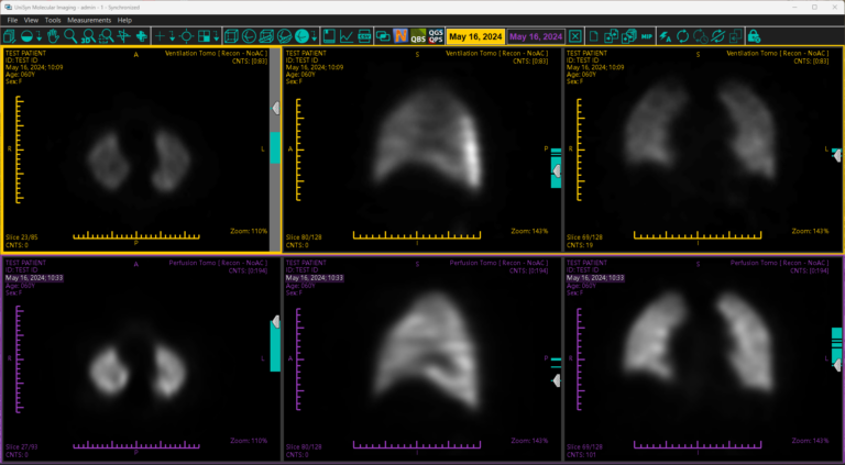 3D Image Math - Convergent Imaging Solutions